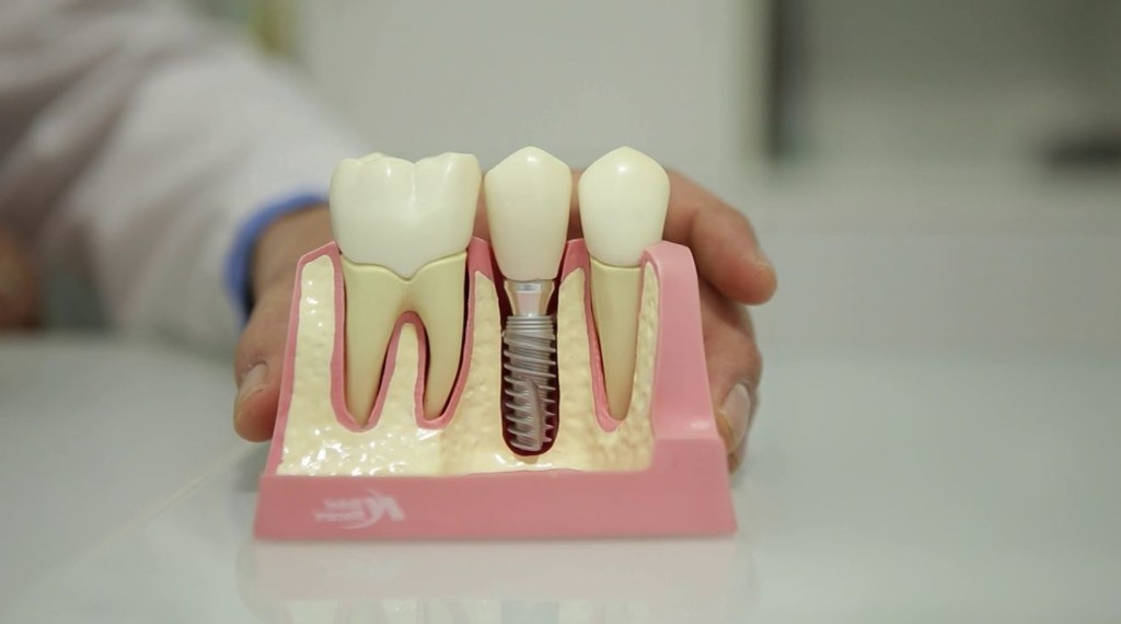 lechenie-zubov-2